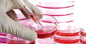 الحكومة الأوكرانية توافق على استخدام الخلايا الجذعية في علاج 3 أمراض