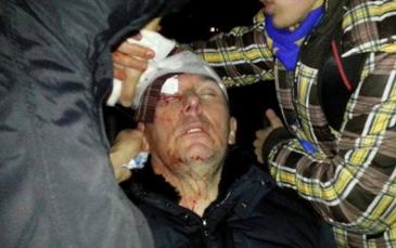 إصابة وزير الداخلية الأوكراني السابق إثر اشتباكات بين الشرطة ومحتجين