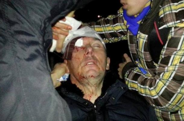 إصابة وزير الداخلية الأوكراني السابق إثر اشتباكات بين الشرطة ومحتجين